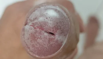 Extreme Burning Sensation Makes the Glans Foam with Arousal.