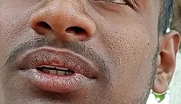 How to Lengthen the Penis but Should Shake the Day