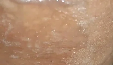 Scrotal Phimosis Results in an Extremely Hot Orgasm.