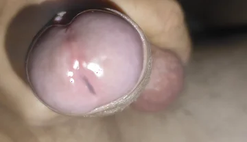 Scrotal Phimosis Results in an Extremely Hot Orgasm.