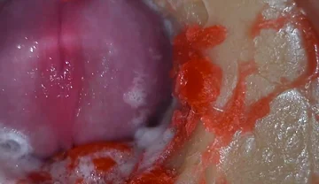 Insemination - Internal Camera Captures Deep Male Ejaculation