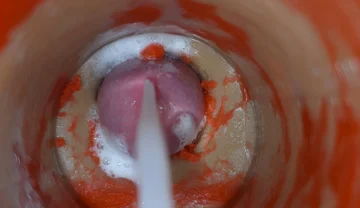 Insemination - Internal Camera Captures Deep Male Ejaculation