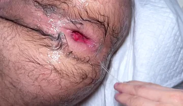 Masked Fister X Fisting Ffunantoni