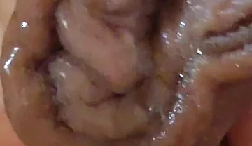 Large Foreskin and Balls in Striking Close-up.