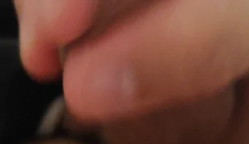 Immense Phimosis Being Extracted Cum and Précum.