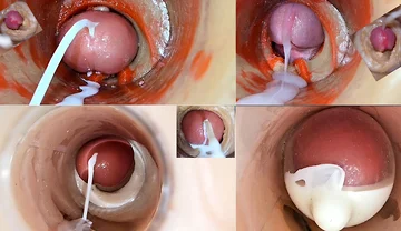 Cumfeti Dripping Creampie Compilation- Endoscopy View