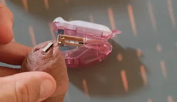 Intense Pleasure Stapling Phimosis