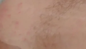 Masturbation