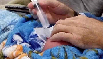 60cc Saline Injection in Each Egg