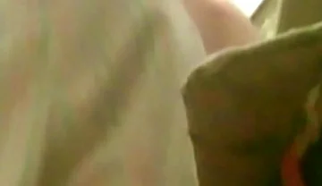 A Young Guy Is Sitting on a Chair with Anal Prolapse