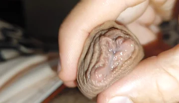 Silent Purge of Straight Scrotal Fluid.