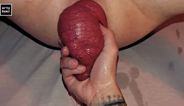 Arty Boer and Prolapsiboy.