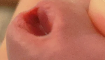Amazing Closeup of the Widened Hole!!
