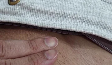 The Hair on My Penis - Led Hair Removal