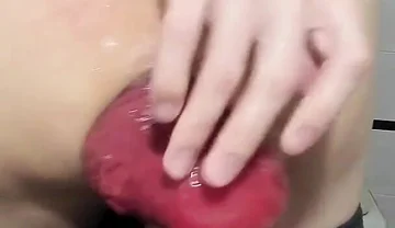 I'm Filming My Huge Hanging Anal Prolapse on a Webcam