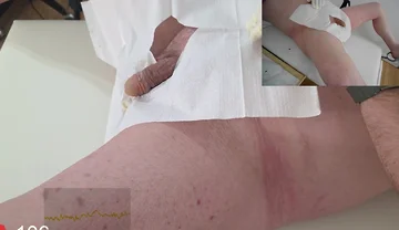 16 French Foley Insertion