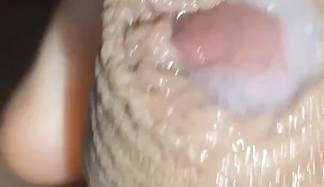I Have the Largest Ejaculating Phimosis in the World!!