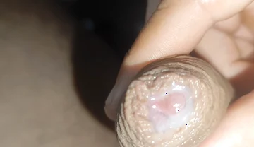 I Have the Largest Ejaculating Phimosis in the World!!