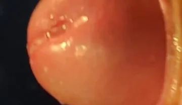 Juicy Close up