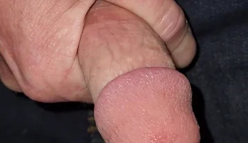 Gaping Urethra - Marker and Pinky Insertion