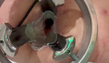 Pouring Hot Candle Wax Into Ass