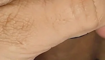 Electrical Pulsation Within the Glans with Rapid Excitation.