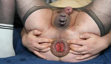 This Has Completely Escalated!