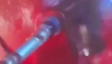 Intense Verbal Play Ahead...