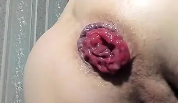 Urethral Prolapse and Anal Prolapse in One Video Xd