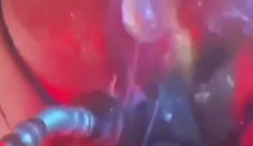 Intense Verbal Play Ahead...