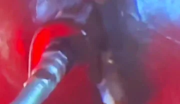 Intense Verbal Play Ahead...