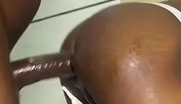 He Damaged His Ass Hole