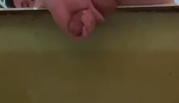 Masturbating a Cock and a Protruding Prolapse