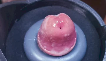 Penis Machine with a New Attachment