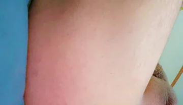 Widening the Ass Opening for Easy Orgasm.