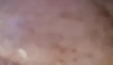 Extreme Fillings Inside My Siliconemeat