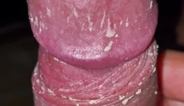 Checking My Dirty Dick