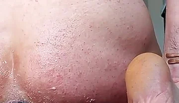 Fireworks of Sperm After a Major Dilation