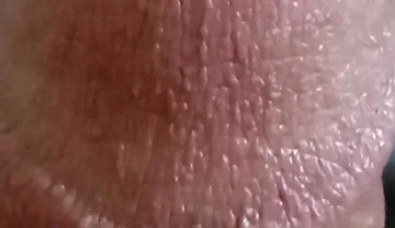 My Dick