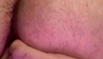Balloon Anal Inflation