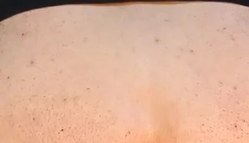 He Enjoys Sucking on His Anal Prolapse