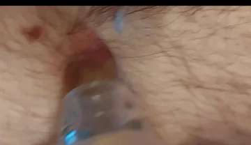 A Close-up Shot of My Belly Button as I Play with It