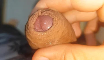 Its Source of Protein Is Already Dawning Like Rock