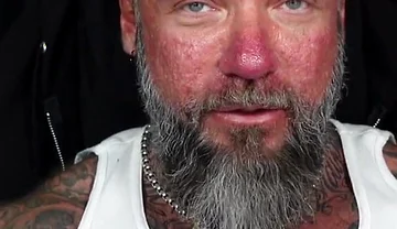 How to Stop Sexual Performance Anxiety