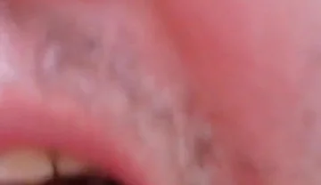 Camera Blunder in the Attempt at Facial Insemination