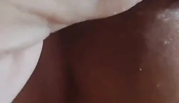 Application of Instant Phimosis Remover.