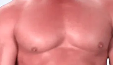 Be My Dental Patient and Pretend to Be Kyle