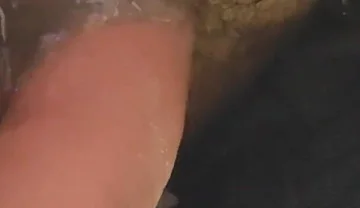 Uncircumcised Phimosis Has the First Ejaculation.