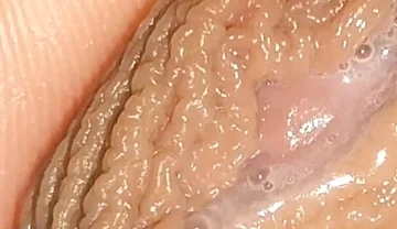 Curious Close-up of Pre-cum in Flaccid Phimosis.