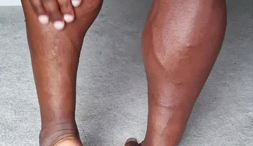 For My Feet Lovers